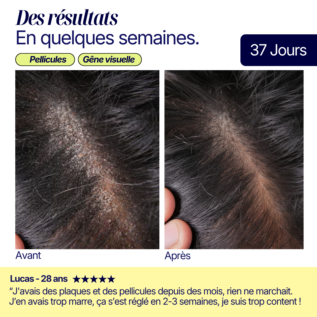 Shampoing Solide Purifiant - Pellicules & Démangeaisons