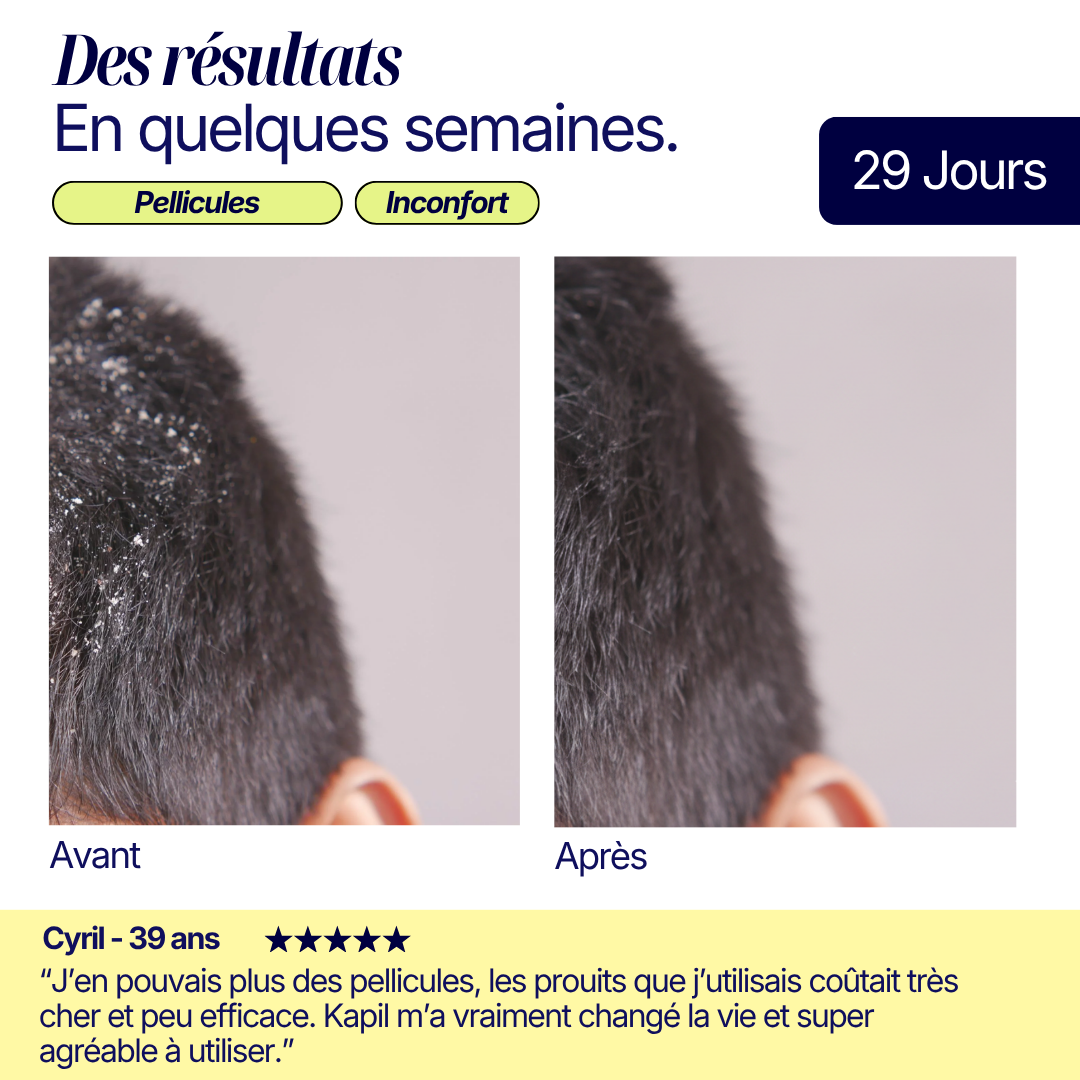 Shampoing Solide Purifiant - Pellicules & Démangeaisons