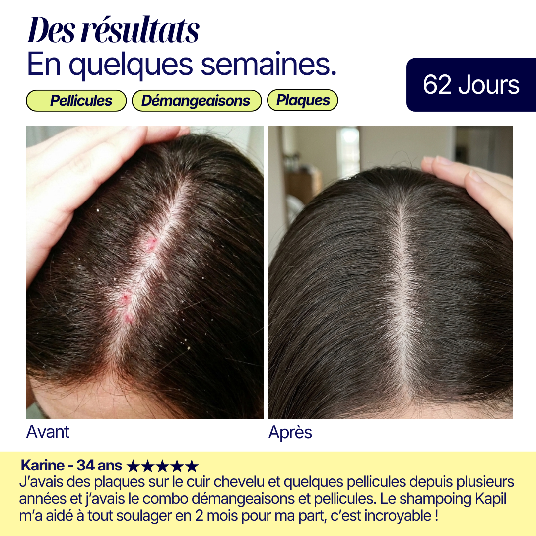 Shampoing Solide - Pellicules & Démangeaisons