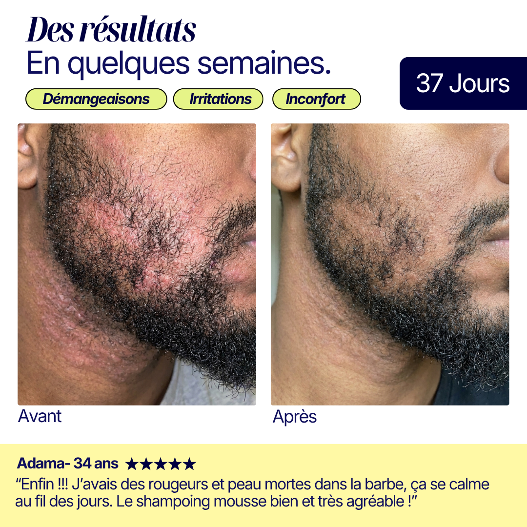 Shampoing Solide Purifiant - Pellicules & Démangeaisons