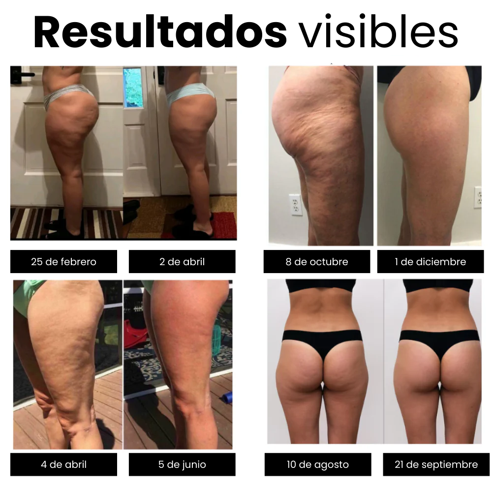 Leggings anticelulíticos Lunaya®